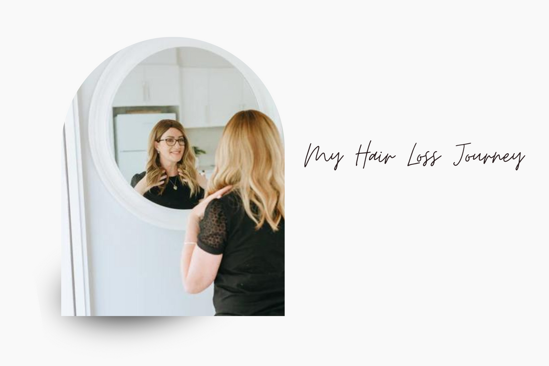 My Hair Loss Journey