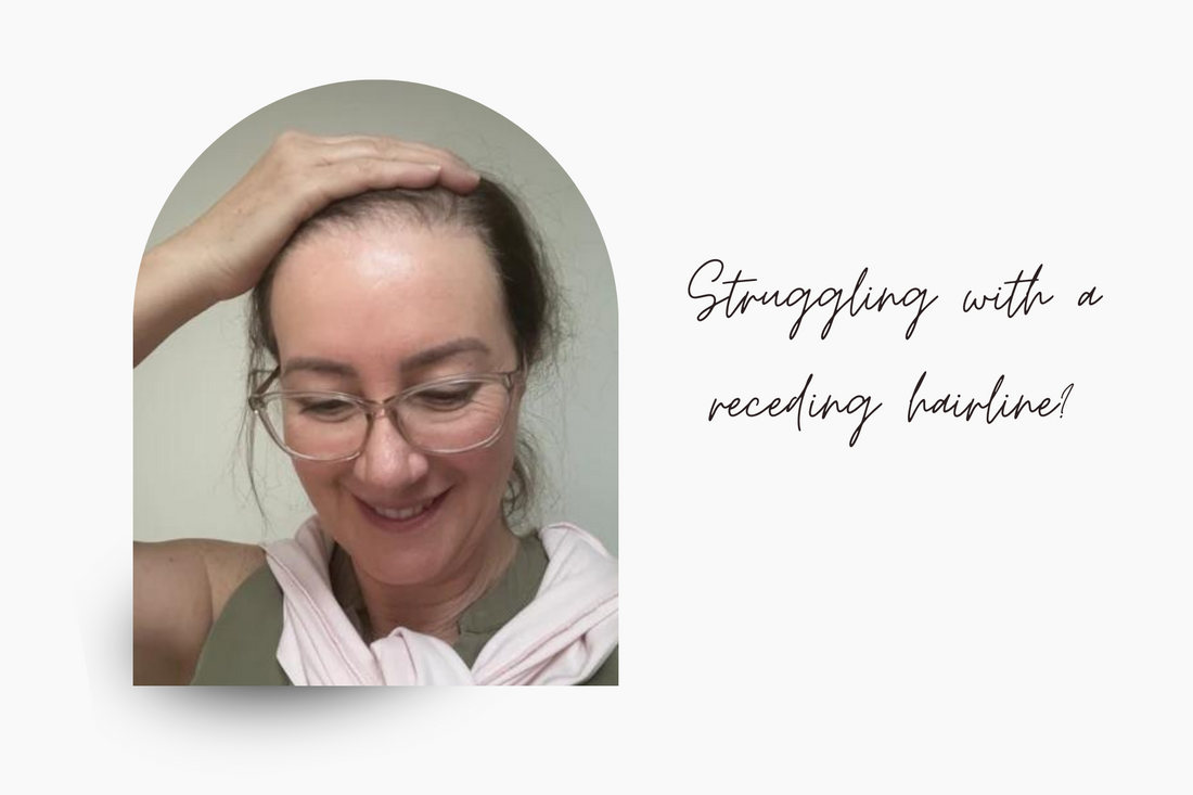 Struggling with a receding hairline? Curious about your options?