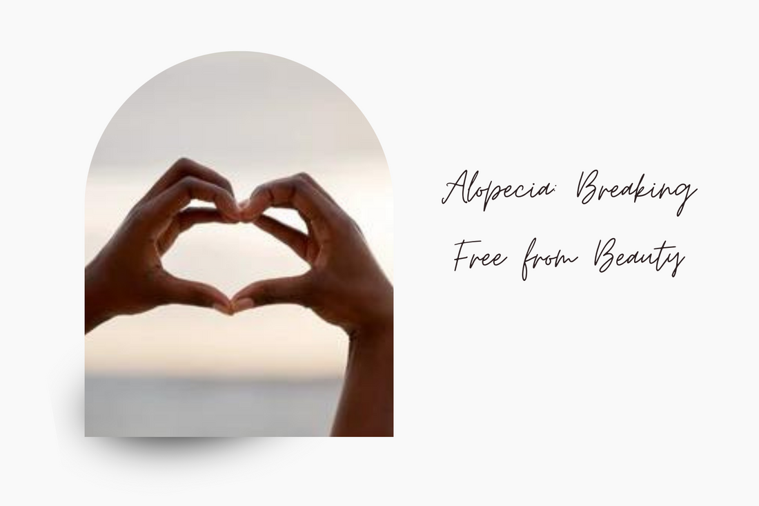 Alopecia: Breaking Free from Beauty Standards and Embracing Hair Loss