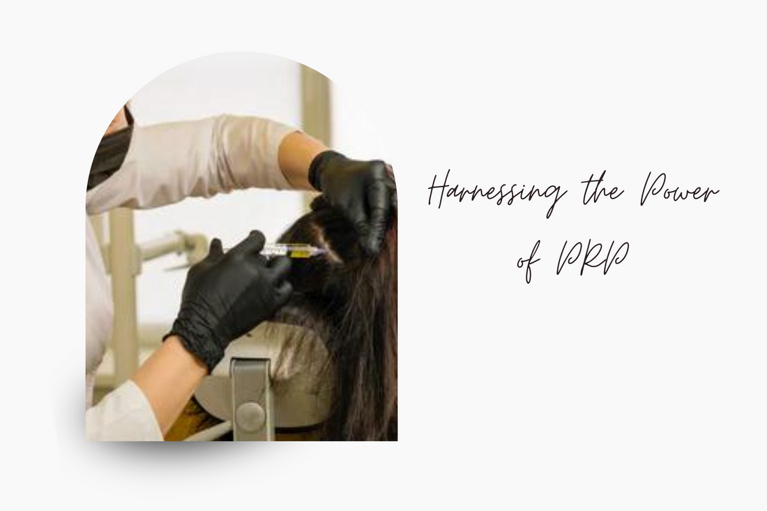 Harnessing the Power of PRP for Female Hair Loss